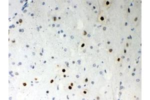 IHC testing of FFPE rat brain with SF2 antibody. (SRSF1 Antikörper)
