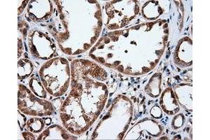 Immunohistochemical staining of paraffin-embedded liver tissue using anti-IFIT1 mouse monoclonal antibody. (IFIT1 Antikörper)