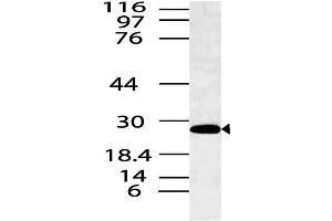Image no. 1 for anti-Spi-B Transcription Factor (Spi-1/PU.1 Related) (SPIB) antibody (ABIN5027786) (SPIB Antikörper)