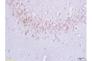 Formalin-fixed and paraffin embedded rat brain labeled with Anti-Plexin B1 Polyclonal Antibody, Unconjugated (ABIN749228) at 1:200 followed by conjugation to the secondary antibody and DAB staining (PLXNB1 Antikörper  (AA 151-250))
