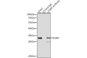 Immunoprecipitation analysis of 200 μg extracts of MCF-7 cells, using 3 μg COMT antibody (ABIN1679321, ABIN3015439, ABIN3015440 and ABIN6216759). (COMT Antikörper  (AA 42-221))