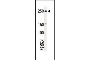 Image no. 1 for anti-C-Ros Oncogene 1 , Receptor tyrosine Kinase (ROS1) (AA 33-63), (N-Term) antibody (ABIN359936) (ROS1 Antikörper  (N-Term))