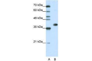 WB Suggested Anti-HNRPA3 Antibody Titration:  1. (HNRNPA3 Antikörper  (N-Term))