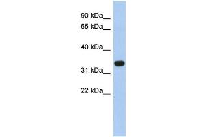 WB Suggested Anti-SULT1B1 Antibody Titration:  0.