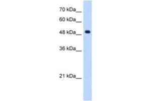 Western Blotting (WB) image for anti-Septin 6 (SEPT6) antibody (ABIN2462958) (Septin 6 Antikörper)
