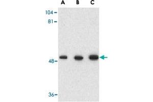 Western blot analysis of GOPC in rat colon cell lysate with GOPC polyclonal antibody  at (A) 1, (B) 2 and (C) 4 ug/mL . (GOPC Antikörper  (C-Term))