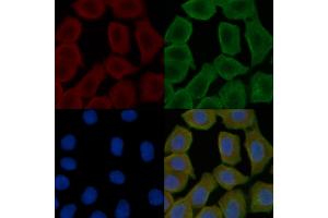 ABIN6258508 and ABIN6274718 staining Hela cells(30 min of UV treatment) by IF/ICC. (MRPS16 Antikörper  (Internal Region))