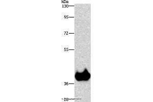 Western blot analysis of Mouse brain tissue, using ASPA Polyclonal Antibody at dilution of 1:1150 (ASPA Antikörper)