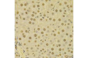 Immunohistochemistry of paraffin-embedded human liver using COPS5 antibody (ABIN5970887) at dilution of 1/100 (40x lens). (COPS5 Antikörper)