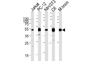 Western blot analysis of lysates from Jurkat,rat PC-12,mouse NIH/3T3,rat C6 cell line and mouse brain tissue (from left to right),using P2K1 Antibody (P1) (ABIN1882101 and ABIN2842058). (MEK1 Antikörper  (N-Term))