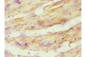 Immunohistochemistry of paraffin-embedded human skeletal muscle tissue using ABIN7144869 at dilution of 1:100 (ATP5O Antikörper  (AA 24-213))
