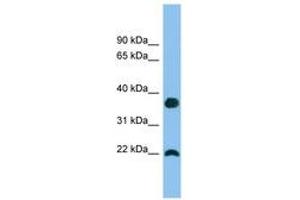 Image no. 1 for anti-WAP Four-Disulfide Core Domain 1 (WFDC1) (C-Term) antibody (ABIN6745156) (WFDC1 Antikörper  (C-Term))