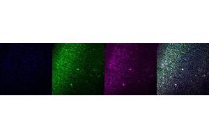 Immunohistochemistry (IHC) image for anti-Calbindin (CALB1) antibody (ABIN7456075) (CALB1 Antikörper)