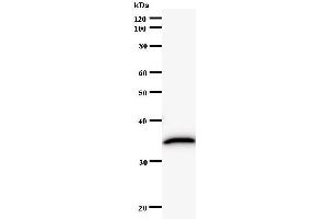 Western Blotting (WB) image for anti-RAR-Related Orphan Receptor C (RORC) antibody (ABIN932197) (RORC Antikörper)