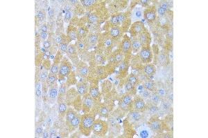 Immunohistochemistry of paraffin-embedded mouse liver using AARS antibody (ABIN7265526) at dilution of 1:100 (40x lens). (AARS Antikörper  (AA 1-100))