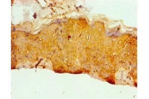 Immunohistochemistry of paraffin-embedded human skin tissue using ABIN7171955 at dilution of 1:100 (ERCC2 Antikörper  (AA 1-300))
