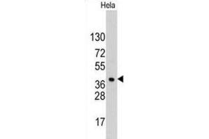 Western Blotting (WB) image for anti-Hepatoma-Derived Growth Factor (HDGF) antibody (ABIN3002632) (HDGF Antikörper)