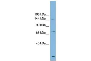 ABCB1 antibody used at 1 ug/ml to detect target protein. (ABCB1 Antikörper)