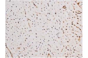 ABIN6267354 at 1/200 staining Mouse heart tissue sections by IHC-P. (MAPT Antikörper  (pSer235))