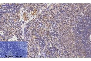 Immunohistochemical analysis of paraffin-embedded rat spleen tissue. (PDGFRA Antikörper)