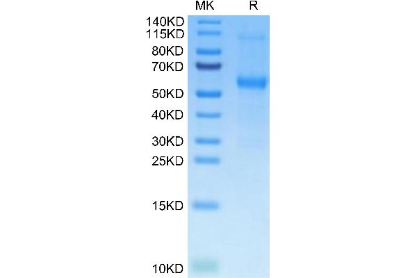 Osteoprotegerin Protein (AA 22-401) (His tag)