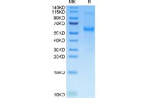 Mouse TNFRSF11B on Tris-Bis PAGE under reduced condition. (Osteoprotegerin Protein (AA 22-401) (His tag))