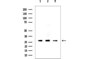 anti-Dickkopf Homolog 1 (DKK1) (Internal Region) antibody