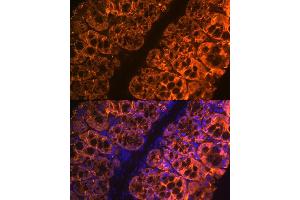 Immunofluorescence analysis of mouse large intestine using Galectin 4/LG Rabbit mAb (ABIN1679347, ABIN3017979, ABIN3017980 and ABIN7101554) at dilution of 1:100 (40x lens). (GAL4 Antikörper)