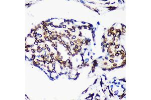 Immunohistochemistry (IHC) image for anti-Lamin A/C (LMNA) antibody (ABIN7268177)