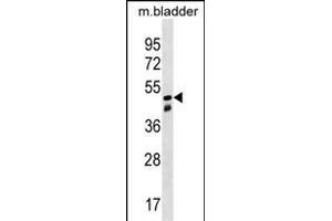 SNX8 Antibody (C-term) (ABIN1537122 and ABIN2849992) western blot analysis in mouse bladder tissue lysates (35 μg/lane). (SNX8 Antikörper  (C-Term))