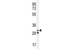 Neutrophil elastase antibody western blot analysis in A2058 lysate. (ELANE Antikörper  (AA 13-39))