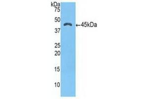 Western blot analysis of recombinant Human a1ACT. (SERPINA3 Antikörper  (AA 235-394))