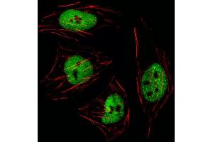 Fluorescent image of Hela cell stained with GTF2I Antibody (N-term) (ABIN1539271 and ABIN2849619)/SA111012BI. (GTF2I Antikörper  (N-Term))