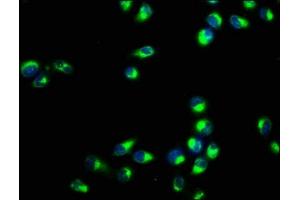 Immunofluorescence staining of Hela cells with ABIN7167196 at 1:400, counter-stained with DAPI. (RAC1 Antikörper  (AA 11-185))