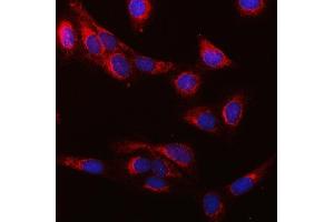 IF analysis of SUCLG1 using anti-SUCLG1 antibody (ABIN7600906). (SUCLG1 Antikörper  (AA 25-346))