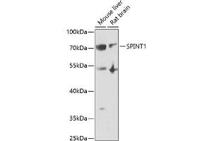 Western blot analysis of extracts of various cell lines, using SPINT1 antibody (ABIN6131743, ABIN6148359, ABIN6148360 and ABIN6222046) at 1:1000 dilution. (SPINT1 Antikörper  (AA 234-513))