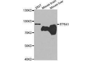 Western blot analysis of extracts of various cell lines, using EPB41 antibody.