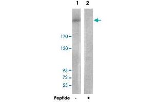 Western blot analysis of extracts from HepG2 cells, using PIKFYVE polyclonal antibody .
