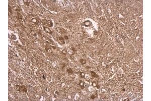 IHC-P Image UBE3A antibody detects UBE3A protein at cytosol on mouse middle brain by immunohistochemical analysis. (ube3a Antikörper)