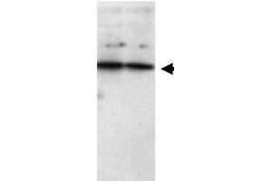 Western blot using  Affinity Purified anti-SFRP1 antibody shows detection of a band ~37 kDa (arrowhead) corresponding to SFRP1 in lysates from human cultured airway epithelial cells. (SFRP1 Antikörper  (AA 12))