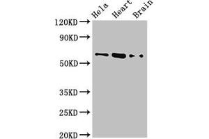 Western Blot Positive WB detected in: Hela whole cell lysate, Mouse heart tissue, Mouse brain tissue All lanes: BAIAP2 antibody at 3. (BAIAP2 Antikörper  (AA 123-368))