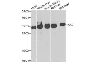Western blot analysis of extracts of various cell lines, using AK2 antibody. (Adenylate Kinase 2 Antikörper  (AA 1-232))