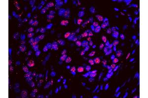 anti-Splicing Factor 3a, Subunit 1 (SF3A1) (AA 300-350) antibody