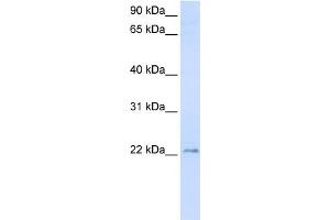 WB Suggested Anti-TMEM9 Antibody Titration:  0. (TMEM9 Antikörper  (C-Term))