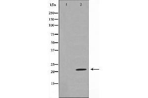 Western blot analysis on rat liver cell lysate using Claudin 7 Antibody,The lane on the left is treated with the antigen-specific peptide. (Claudin 7 Antikörper  (C-Term))