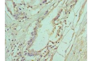 Immunohistochemistry of paraffin-embedded human prostate tissue using ABIN7156772 at dilution of 1:100 (IL11RA Antikörper  (AA 30-290))