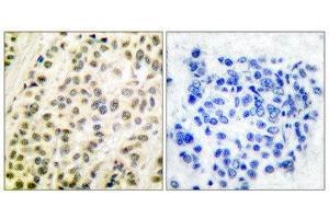 Immunohistochemistry (IHC) image for anti-Transglutaminase 4 (Prostate) (TGM4) (C-Term) antibody (ABIN5976383) (TGM4 Antikörper  (C-Term))