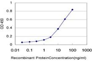 Detection limit for recombinant GST tagged ERN1 is approximately 1ng/ml as a capture antibody. (ERN1 Antikörper  (AA 401-500))