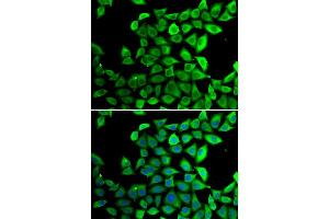 Immunofluorescence analysis of U20S cell using PPID antibody. (PPID Antikörper)