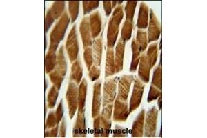 S3 antibody (N-term) 0390a immunohistochemistry analysis in formalin fixed and paraffin embedded human skeletal muscle followed by peroxidase conjugation of the secondary antibody and DAB staining. (AP1S3 Antikörper  (N-Term))